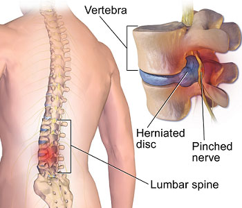 spine surgeon in Baner, Pune